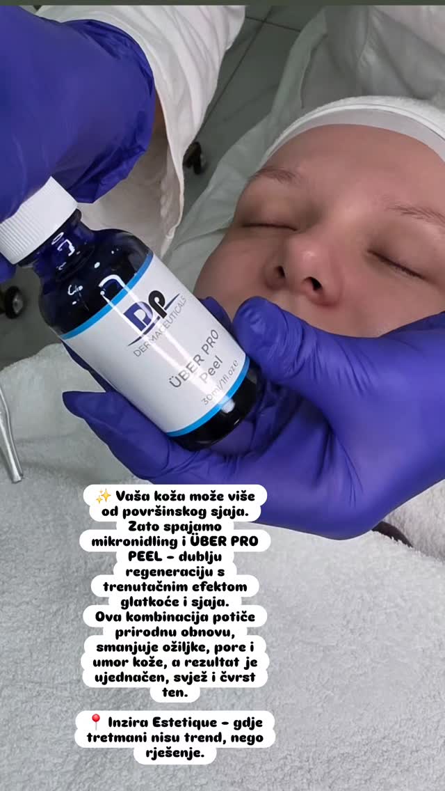 Über Pro Peel + mikroneedling tretman